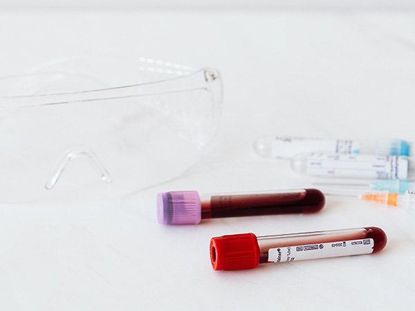 Antibody test sample for diabetes