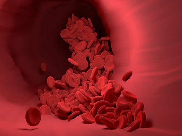 damage to blood vessels in the diabetes